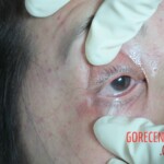 Dead woman in hospital