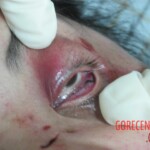 Dead woman in hospital