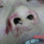 Dead woman in hospital