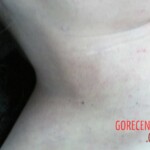 Dead woman in hospital