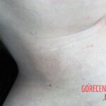 Dead woman in hospital