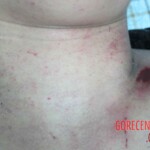 Dead woman in hospital