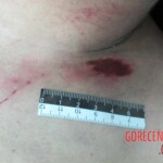 Dead woman in hospital