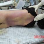 Dead woman in hospital