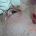 Dead woman in hospital