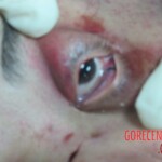 Dead woman in hospital