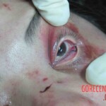 Dead woman in hospital