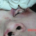 Dead woman in hospital