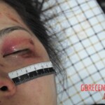 Dead woman in hospital