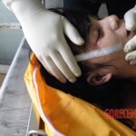 Woman's body examination in morgue