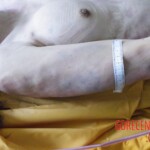 Woman's body examination in morgue