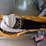 Woman's body examination in morgue
