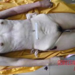 Woman's body examination in morgue