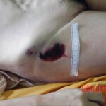 Woman's body examination in morgue