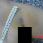 Young Chinese girl dies of heart failure