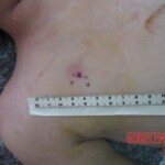 Dead young girl in morgue