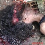 Girl with smashed head