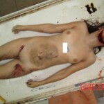 Naked woman in morgue