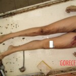 Naked woman in morgue