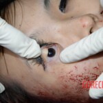 Woman feel from building