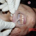 Woman feel from building