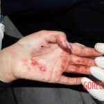 Woman feel from building