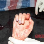 Woman feel from building