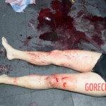 Woman feel from building