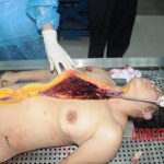 Chinese woman in morgue