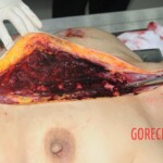 Chinese woman in morgue