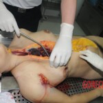 Chinese woman in morgue