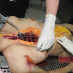 Chinese woman in morgue