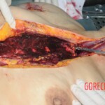 Chinese woman in morgue