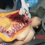Chinese woman in morgue