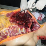 Chinese woman in morgue