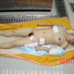 Chinese woman in morgue