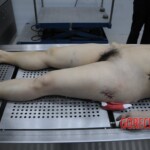 Chinese woman in morgue