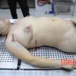 Chinese woman in morgue