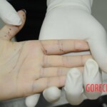 Chinese woman in morgue