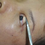 Chinese woman in morgue