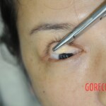 Chinese woman in morgue