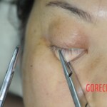 Chinese woman in morgue