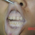 Chinese woman in morgue