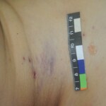 Chinese woman in morgue