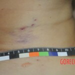 Chinese woman in morgue