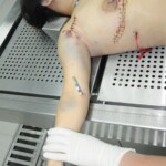 Chinese woman in morgue