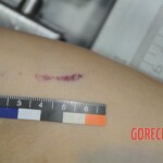 Chinese woman in morgue