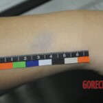 Chinese woman in morgue