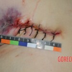 Chinese woman in morgue