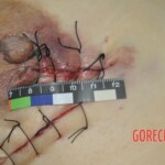 Chinese woman in morgue